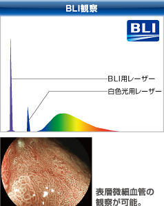 発光強度で切り替えられる観察タイプ